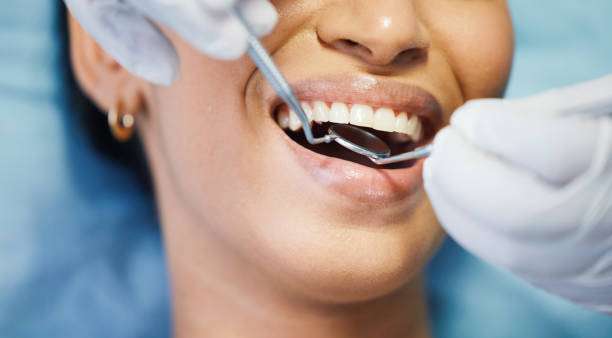 Best Emergency Dentist for Lost Fillings or Crowns in Montgomery, IL