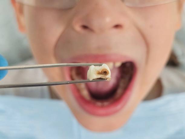 Best Orthodontic Emergency Dentist in Montgomery, IL